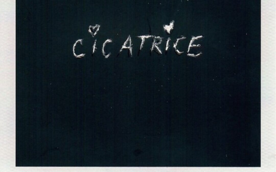 Non sai come curare la tua Cicatrice? Ci pensa Clara!